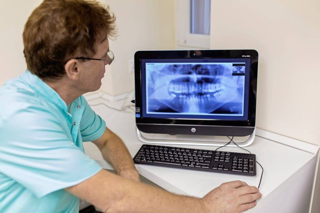 Fogászati röntgen kiértékelése
