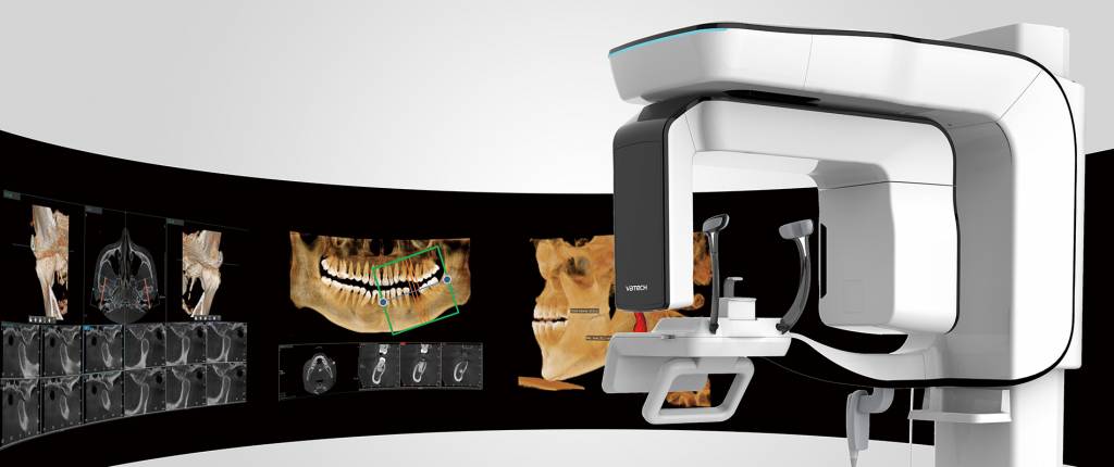 CBCT Poncz Dental Budapest