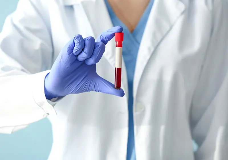 PRF Platelet Rich Fibrin kezelés